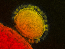 Китай не торопится передавать РФ штамм коронавируса