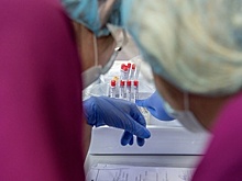Сервис доставки «Самокат» проверяет на коронавирус своих сотрудников