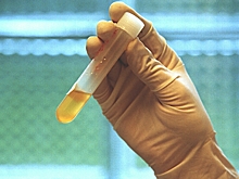 Эксперт рассказал о схеме обмана с «плохими анализами»