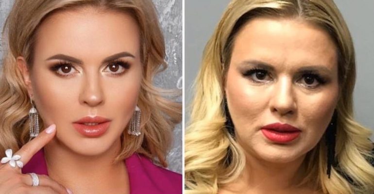 Анна Семенович Фото Без Фотошопа