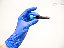 Диетолог перечислила признаки дефицита железа