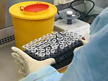 В два раза выросло число новосибирцев с антителами к коронавирусу