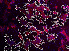 Проводящие клетки сердечной ткани оказались способны к самоорганизации