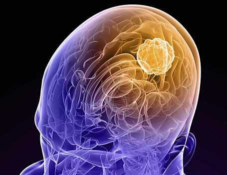 Противоотечные препараты при раке ослабляют иммунитет на недели после приема
