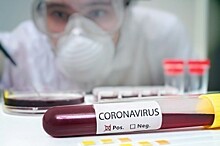 Еще трое калужан скончались от коронавируса за сутки