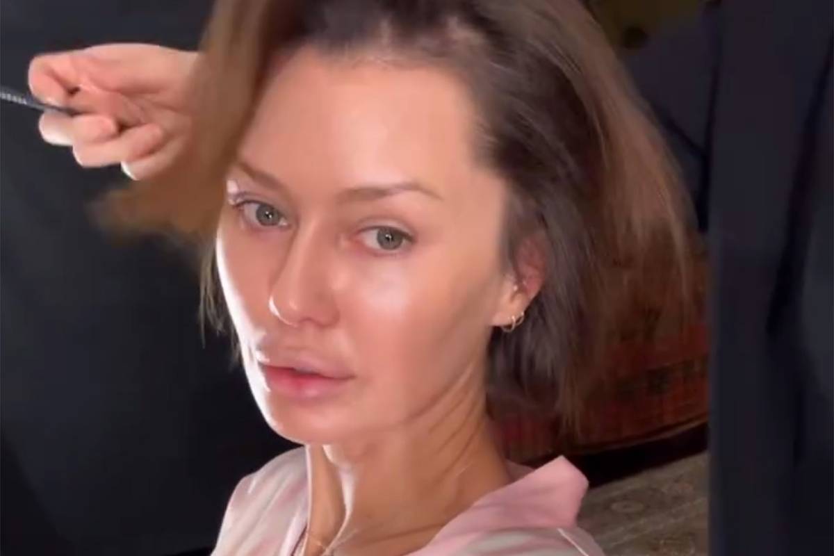 Виктория Боня показала лицо без макияжа и фильтров после пластики