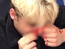 Мужчина избил двоих подростков за пирсинг в подмосковной электричке