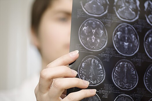 Учёные предложили метод исследования рака мозга за 10 минут