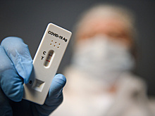 Суточная госпитализация Covid‑пациентов в Москве уменьшилась на 9,7%