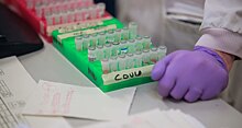 Препарат от ВИЧ смог остановить размножение коронавируса