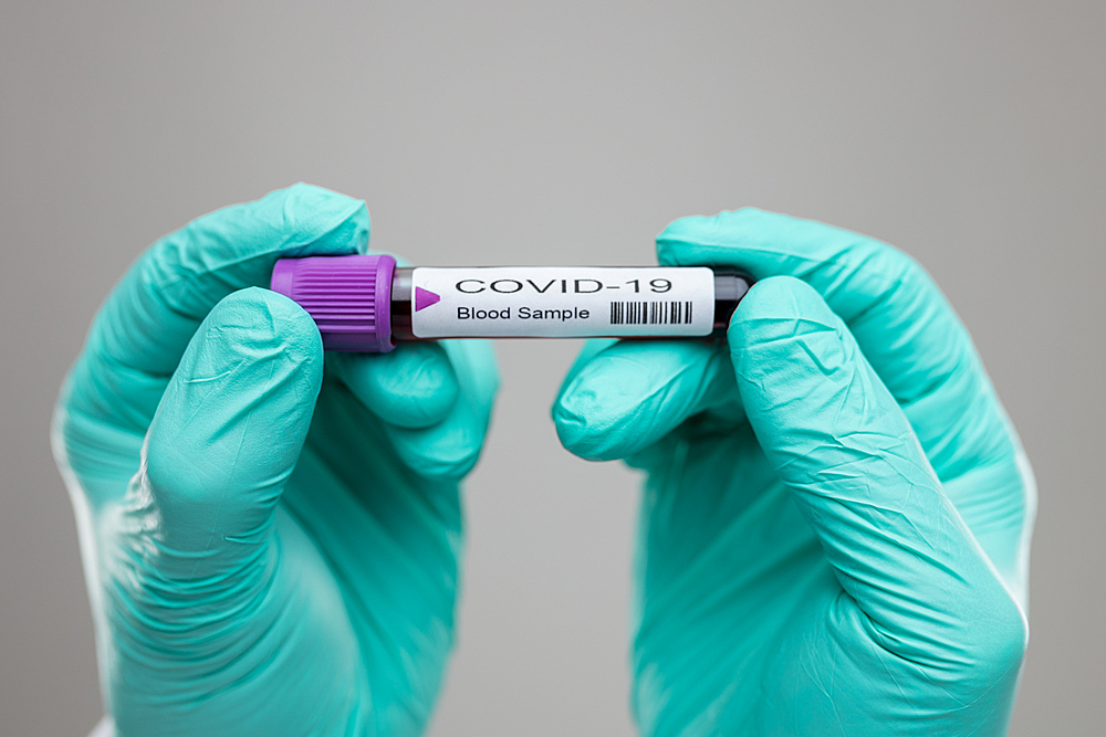 Обнаружена главная уязвимость коронавируса