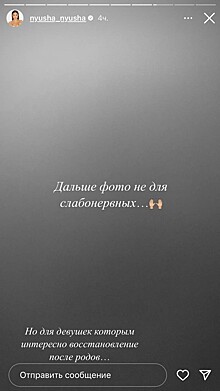 Нюша показала, как восстанавливается после родов, и напугала подписчиков