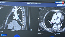 Прорывное направление: столичные больницы осваивают ядерную диагностику