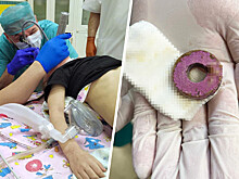 Медики спасли мальчика, у которого в пищеводе застряла деталь игрушки