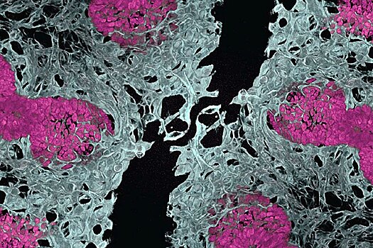 Ученые вырастили мини-легкие с кровеносными сосудами для изучения болезней