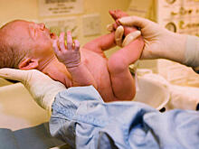 Почему всем мальчикам в США принято делать обрезание