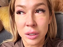 Экс-участница «Дома-2» призналась, что ей едва не удалили матку