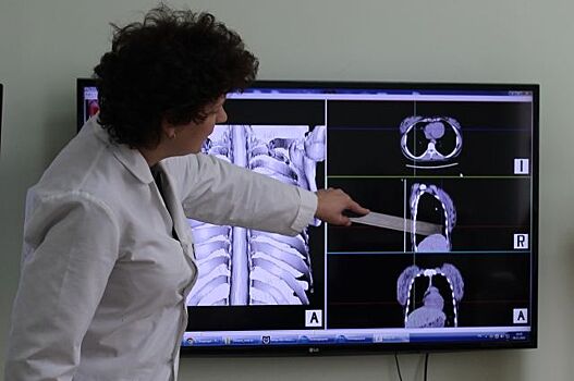 Российские ученые изобрели новый высокоточный тест на туберкулез