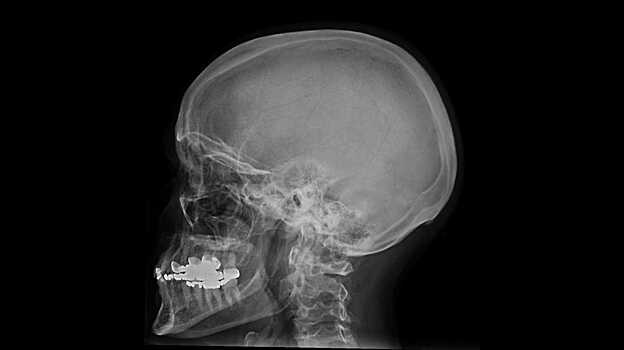 Курение сочли более опасным, чем «бытовую» радиацию