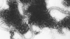 США потребовали от стран данные о “патогенах с эпидемическим потенциалом”