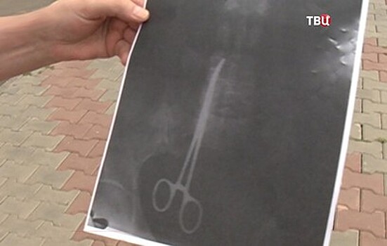 Красноярские врачи забыли в теле пациентки 20-сантиметровый зажим