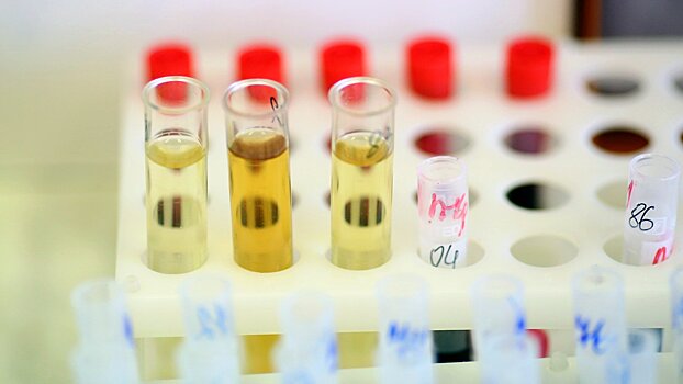 Названы три характеристики идеальной мочи