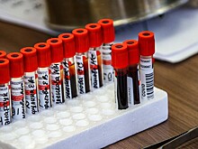 Число заболевших COVID-19 в мире выросло за сутки на 278 тысяч