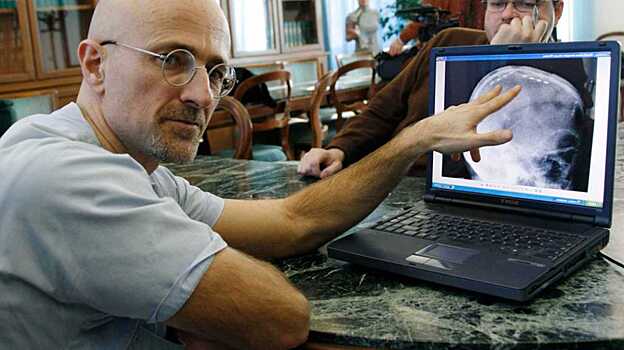 Главное за неделю: про пересадку головы трупу, исчезновение пятен на Солнце и интеллект геймеров