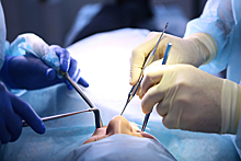 Российский врач назвал пересадку зубов новым трендом