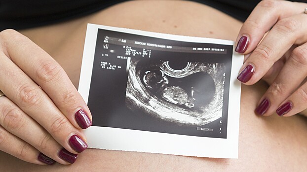В Госдуме предложили увеличить временные рамки на посещение врача для беременных