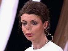 Алиса Аршавина прошла через 9 операций на нос после его почти полной потери