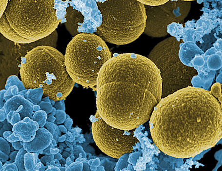 Золотистый стафилококк ускоряет размножение SARS-CoV-2 в 10 раз