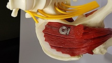 Новый биоразлагаемый имплантат ускорит восстановление повреждённых нервов