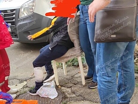 Стая бродячих собак разорвала ногу школьнику в Краснодаре