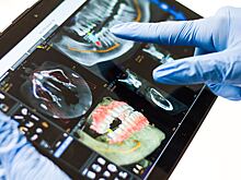 В Башкирии начнут печатать импланты на 3D-принтере