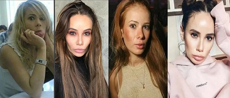 Айза до пластики фото