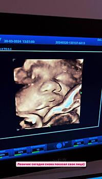 Звезда «Дома-2» Тигран Салибеков и его 23-летняя возлюбленная поделились кадрами из кабинета УЗИ и показали лицо сына‎