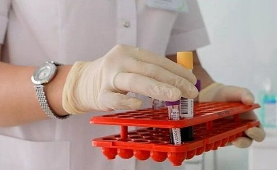 В Роспотребнадзоре Татарстана рассказали, как разные тесты могут показать разные результаты