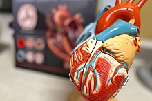 В РФ разработали первый в мире аортальный клапан из донорского перикарда