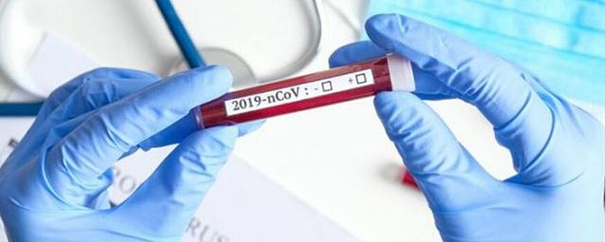 В Коми уже 111 пациентов вылечились от коронавируса