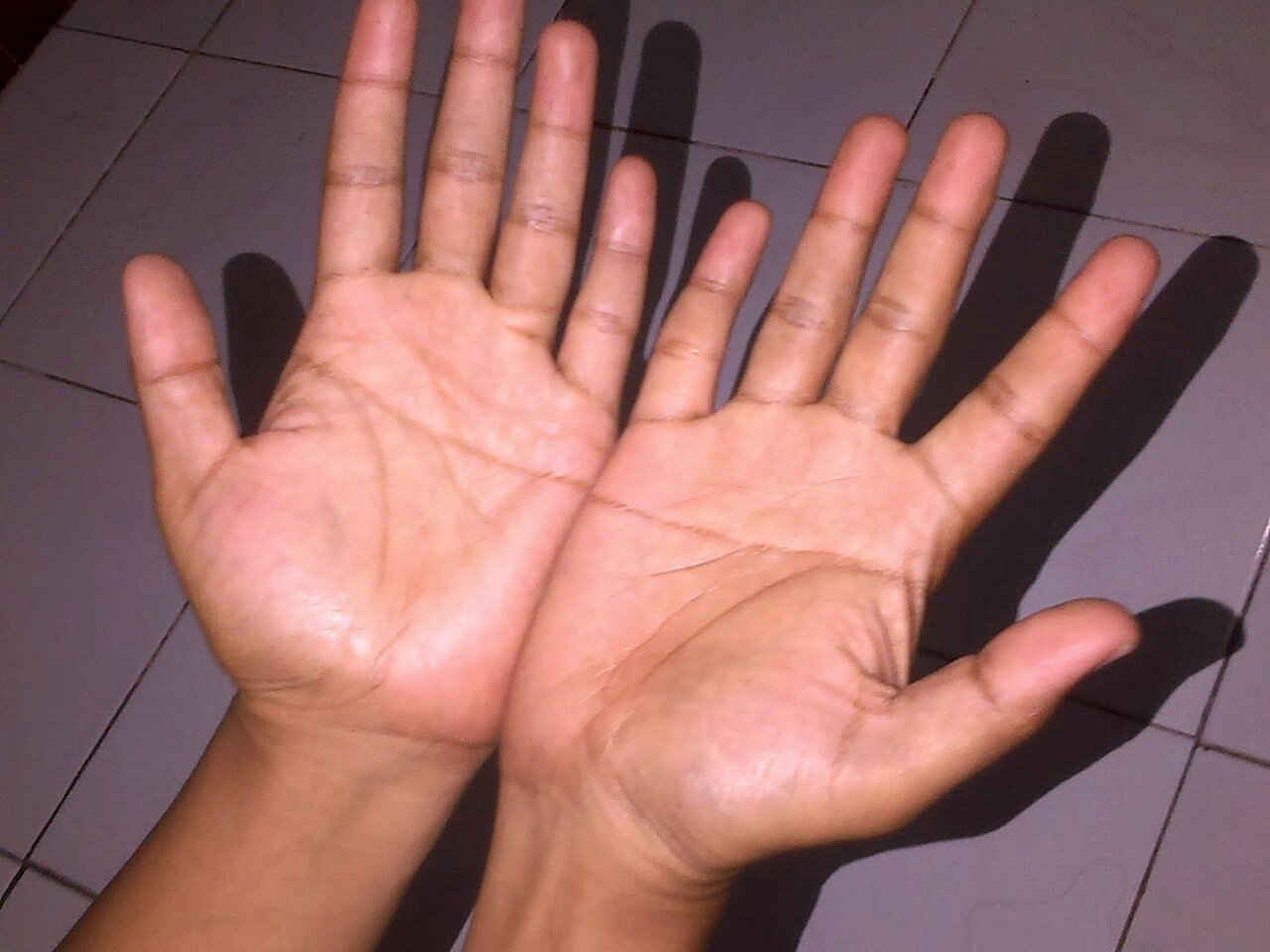 хиромантия обезьянья складка. ладонь человека. хиромантия обезьянья линия. редкие руки. сатурн хиромантия.