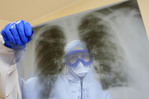 Смертность от туберкулеза в России достигла исторического минимума