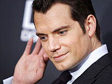 Генри Кавилл показал фанатам лицо со следами побоев