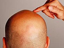 Водитель-курьер украл средства против облысения на 170 тысяч