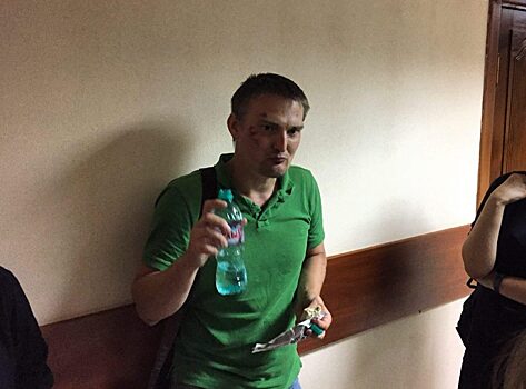 К избитому адвокату Беньяшу не пустили защитника из-за устного приказа начальника УВД. Такие же приказы исполняют во время протестных акций