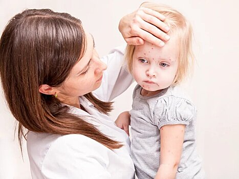Бледность, круги под глазами и нездоровый цвет лица у ребенка: что должно насторожить родителей