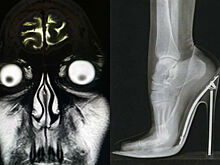 12 рентген-снимков, которые шокировали врачей