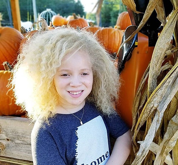 Эта маленькая красавица тоже альбинос. Если бы природа не добавила свой особенный штрих в ее внешность, кожа и волосы этой девочки были бы такими же темными, как у любой другой афроамериканки.