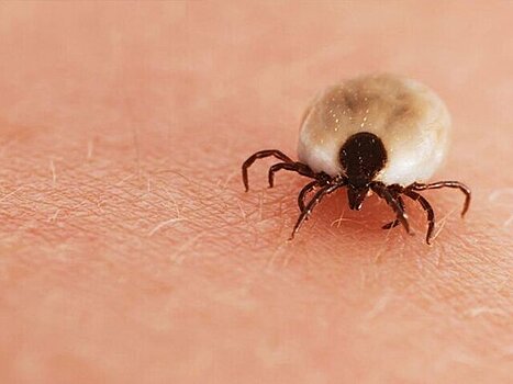 Врач Тен посоветовал надевать одежду с длинными рукавами, чтобы защититься от клещей