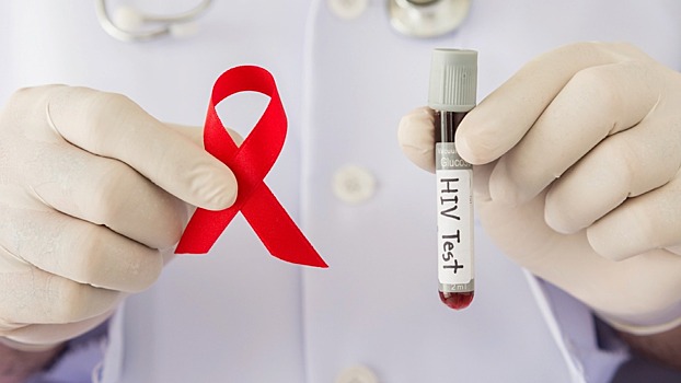 Анонимно и бесплатно: вологжан призывают сдать тест на ВИЧ